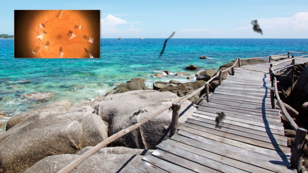 Example picture-in-picture point of view of disease progression simulation in Rendia