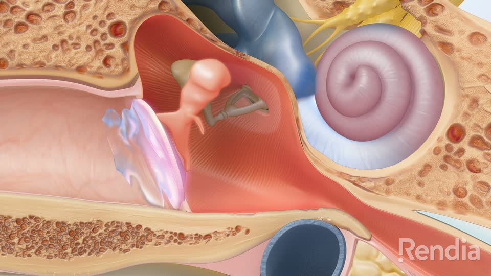 Myths and Facts About Over-the-Counter Hearing Aids