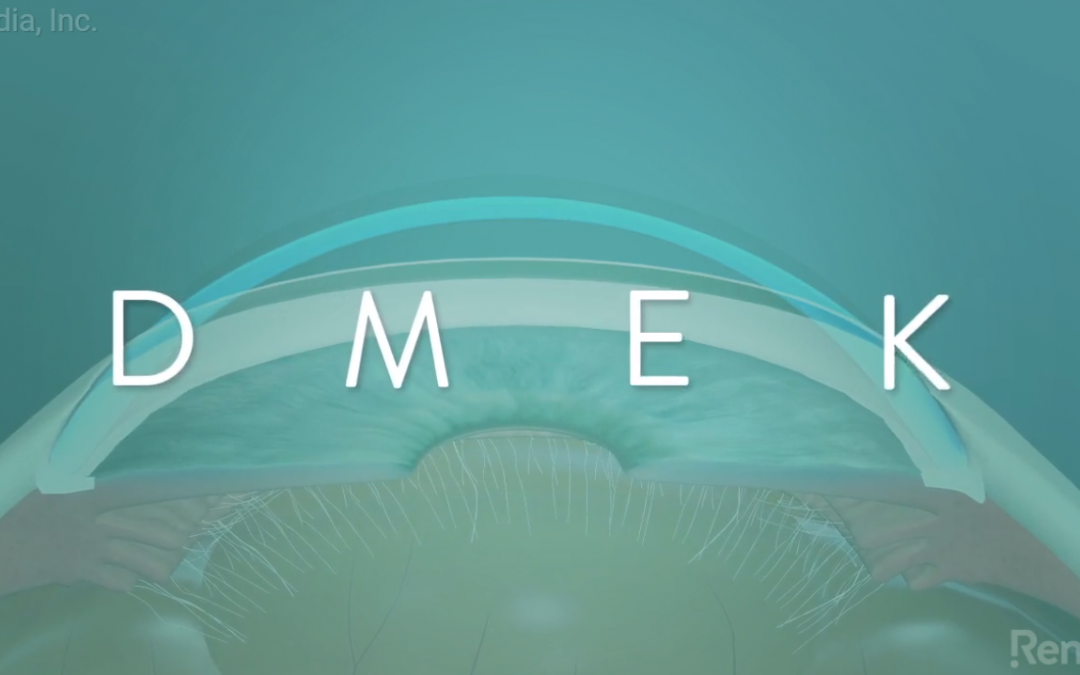 New Eye Care Videos Explain IOLs, DMEK, MIGS to Patients